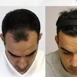 Zmdglowhair Zmdglowhair